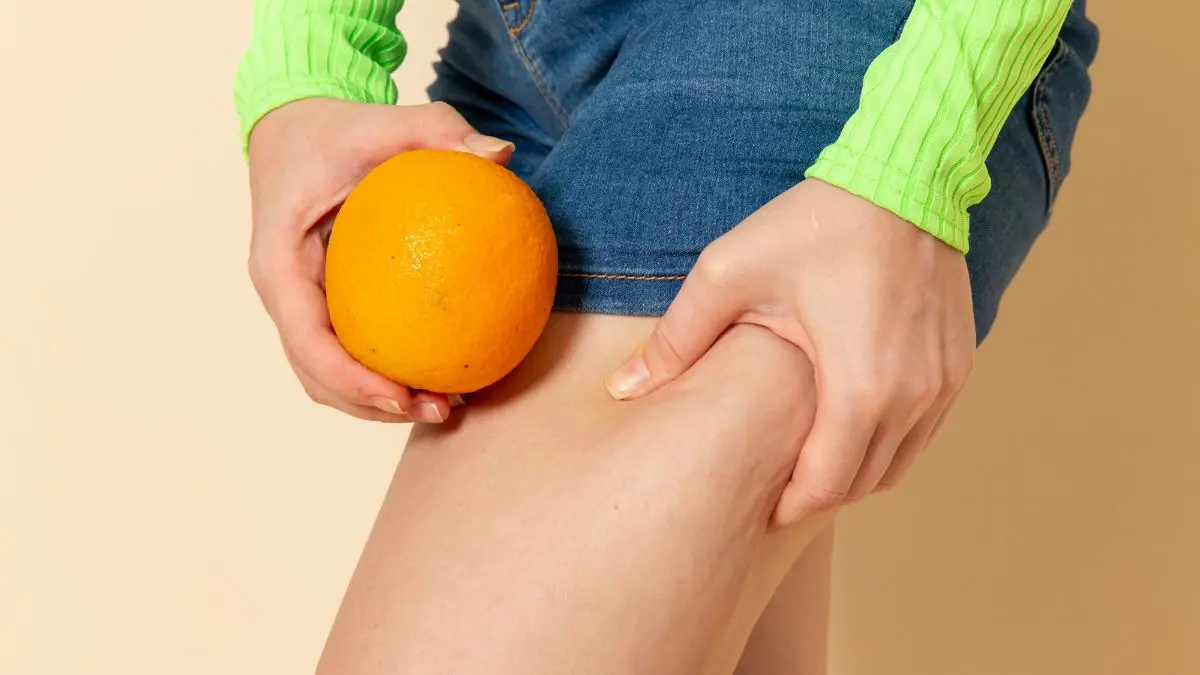 Cellulite Myths Debunked: Separating Fact From Fiction