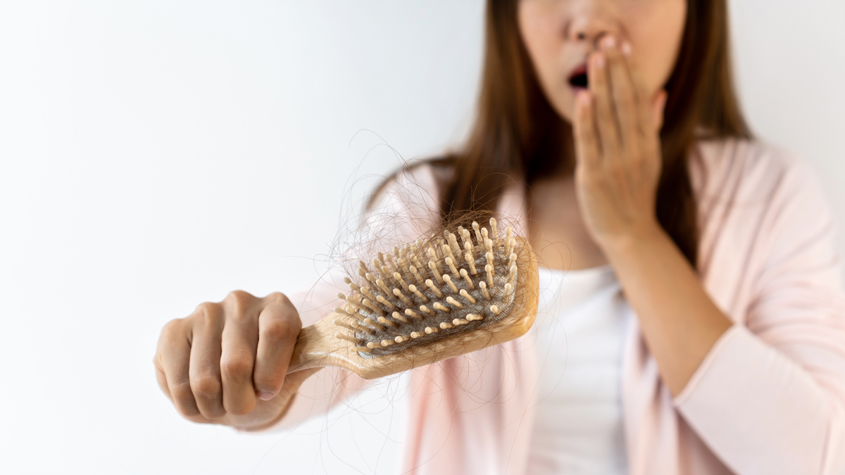 Common Causes of Hair Loss