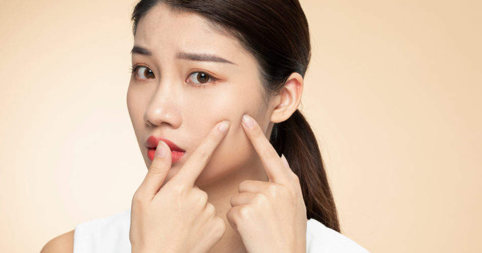 Oily Skin, Go Away: Beat the Blues With the Best Tips!