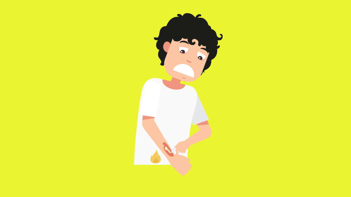 Recently Been Burned? Here's What You Need to Do