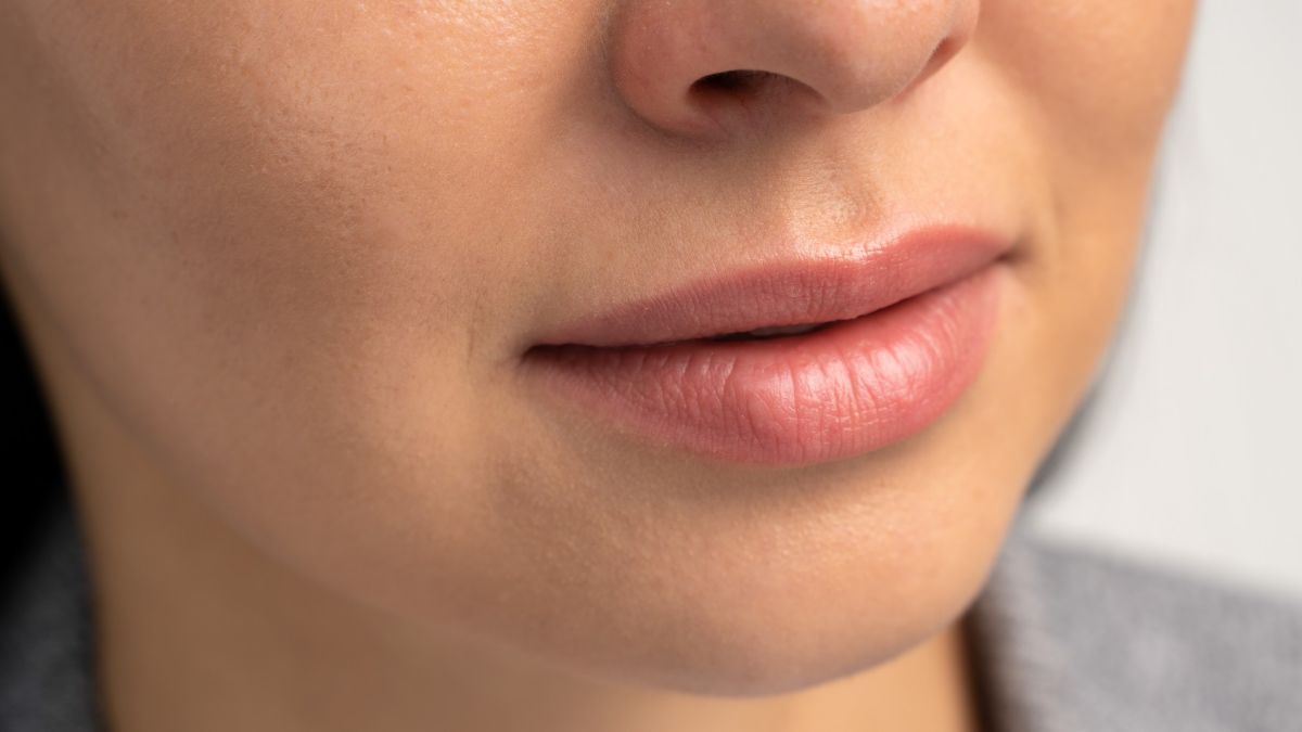 How Long Does Dermal Filler Last in Lips?